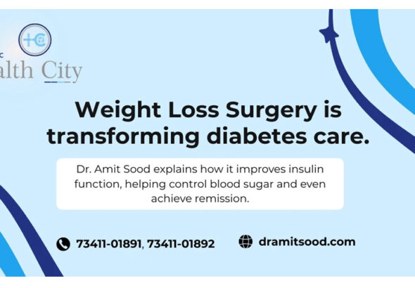Dr Amit Sood, Weight Loss Surgery, best Bariatric Weight loss surgeon in Panchkula