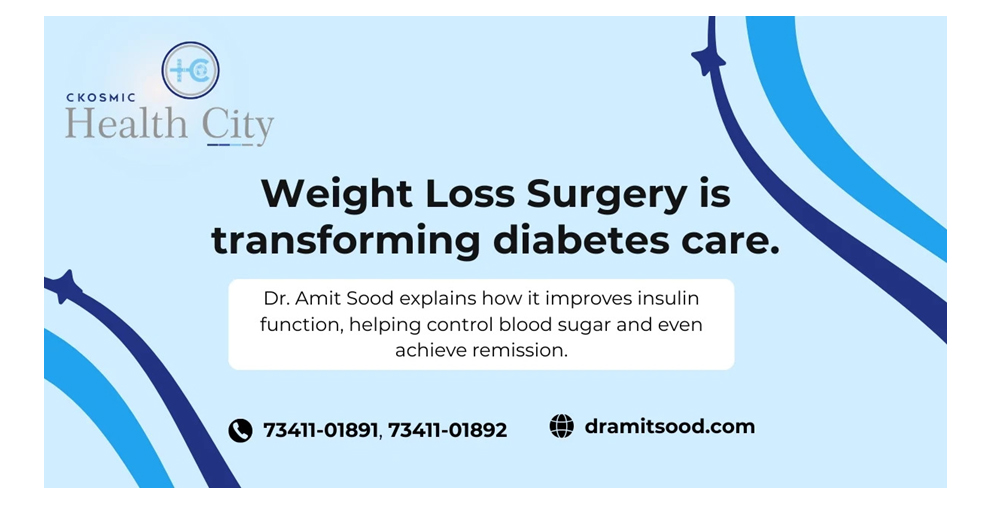 Dr Amit Sood, Weight Loss Surgery, best Bariatric Weight loss surgeon in Panchkula